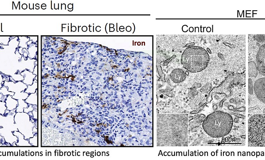  La UC participa en un estudio que descubre que la acumulación de hierro es esencial en el desarrollo de enfermedades fibróticas
